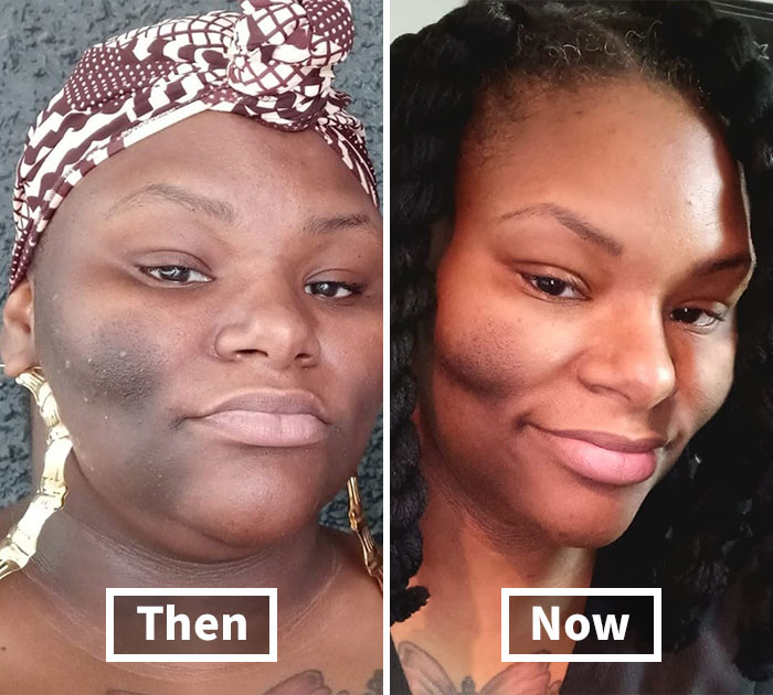 When It Comes To Your Skin, These Soap Bars Know There's No 'Kojic' Reason To Settle For Dark Spots. Watch Your Skin Transform From 'Meh' To Mesmerizing!