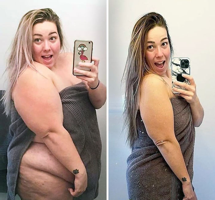 "Let Your Smile Change The World But Don't Let The World Change Your Smile." Before vs. After