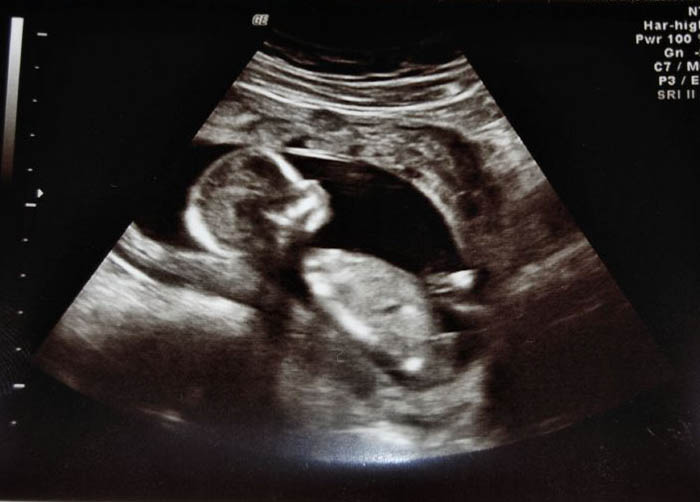 29 Things People Considered To Be Their Hill To Die On But Later Changed Sides Drastically