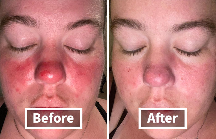 Calm Your Skin In A Flash With Dearklairs Midnight Blue Calming Cream 