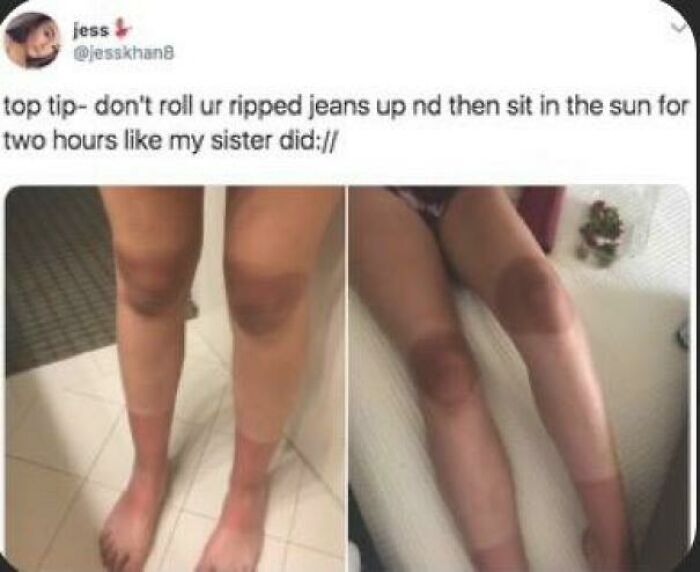 The Sun Really Sucks