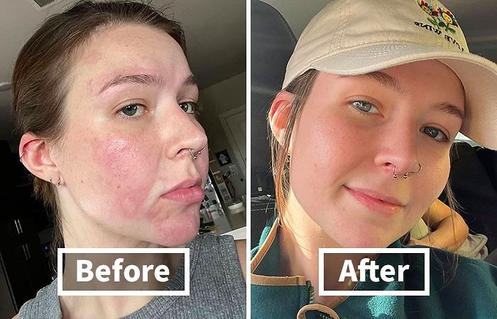 Transform Your Skin With COSRX Snail Mucin Power Repairing Essence: Hydrating Serum With Snail Secretion Filtrate For Revitalizing Dull Skin!