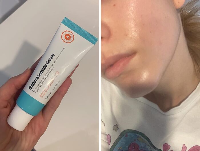 Double The Healing: A'pieu's Madecassoside 2x Cream For Ultra-Soothing Skin Care!