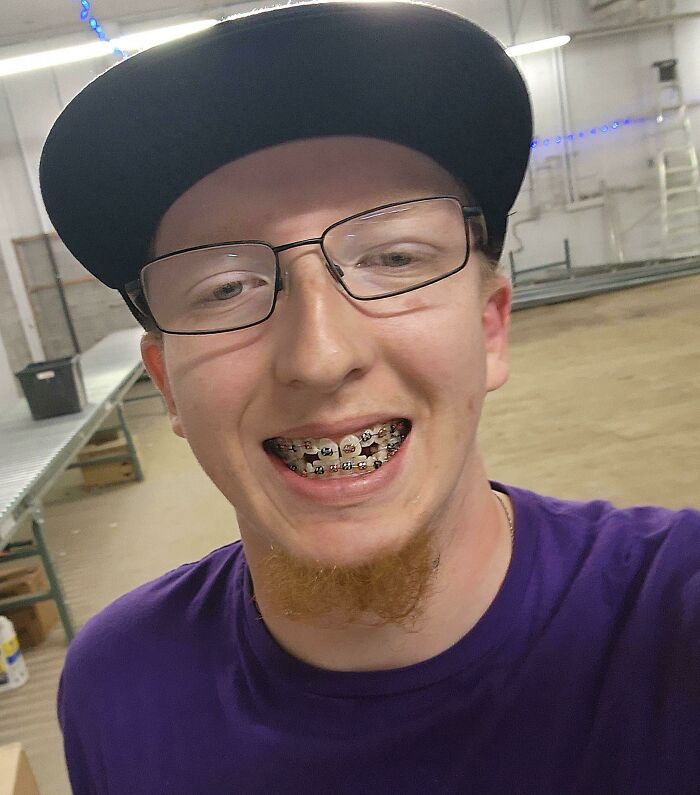 Finally Can Afford To Get My Teeth Fixed After A Childhood Of No Dental Help