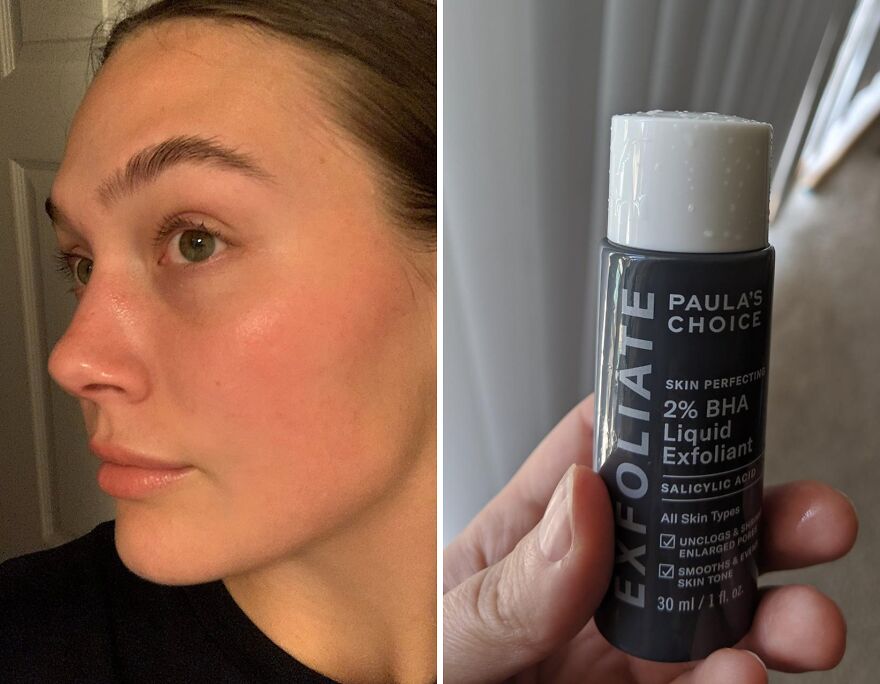  Paula's Choice 2% Bha : Your Ultimate Defense Against Blackheads And Wrinkles