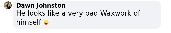 &ldquo;What On Earth Has He Done?&ldquo;: Simon Cowell Reveals Dramatic Facial Change