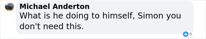 &ldquo;What On Earth Has He Done?&ldquo;: Simon Cowell Reveals Dramatic Facial Change