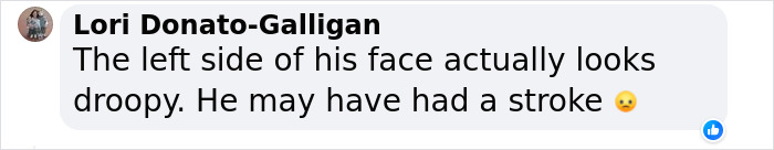 &ldquo;What On Earth Has He Done?&ldquo;: Simon Cowell Reveals Dramatic Facial Change