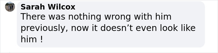 &ldquo;What On Earth Has He Done?&ldquo;: Simon Cowell Reveals Dramatic Facial Change