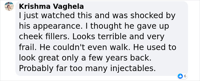 &ldquo;What On Earth Has He Done?&ldquo;: Simon Cowell Reveals Dramatic Facial Change