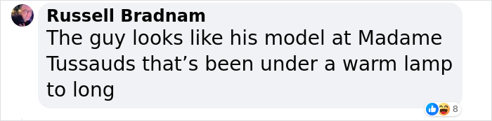 &ldquo;What On Earth Has He Done?&ldquo;: Simon Cowell Reveals Dramatic Facial Change