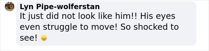 &ldquo;What On Earth Has He Done?&ldquo;: Simon Cowell Reveals Dramatic Facial Change