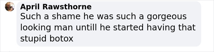 &ldquo;What On Earth Has He Done?&ldquo;: Simon Cowell Reveals Dramatic Facial Change