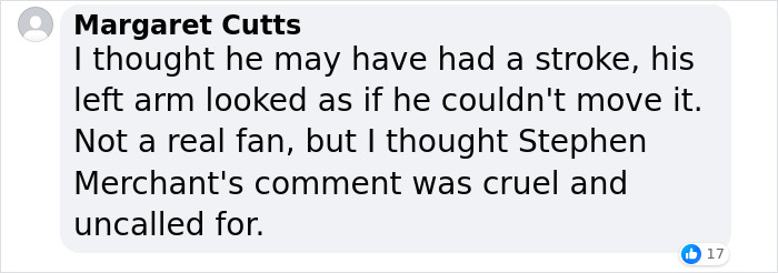 &ldquo;What On Earth Has He Done?&ldquo;: Simon Cowell Reveals Dramatic Facial Change