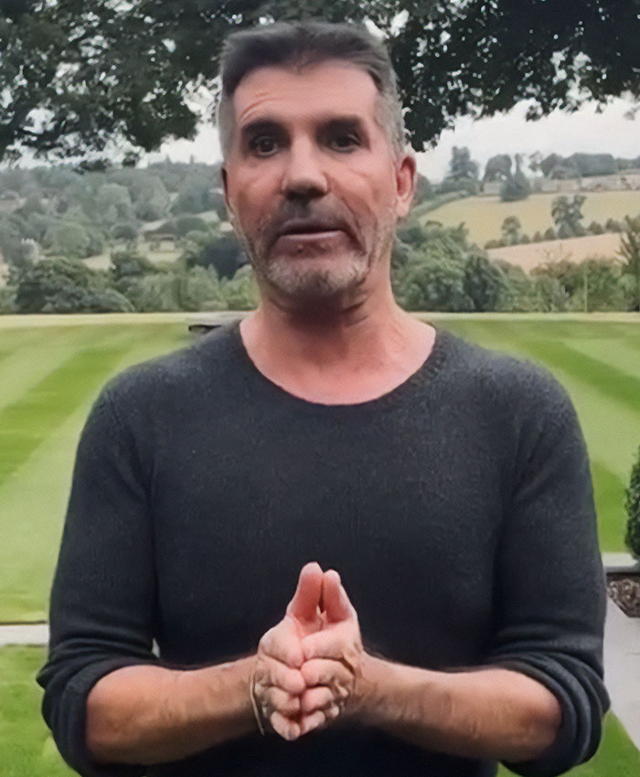 &ldquo;What On Earth Has He Done?&ldquo;: Simon Cowell Reveals Dramatic Facial Change