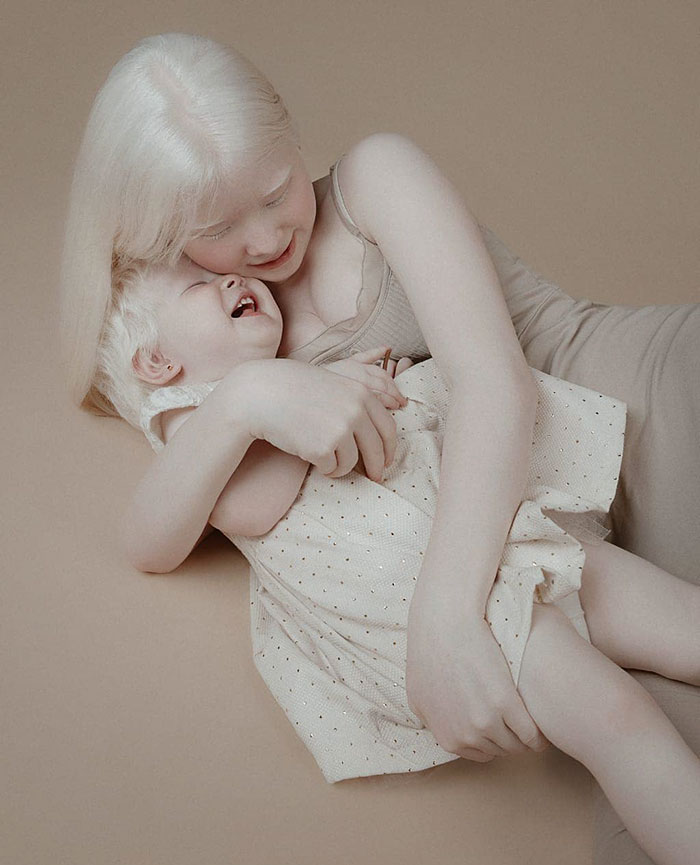 Albino Sisters Born 12 Years Apart Stun The World With Their Extraordinary Beauty (24 Pics)
