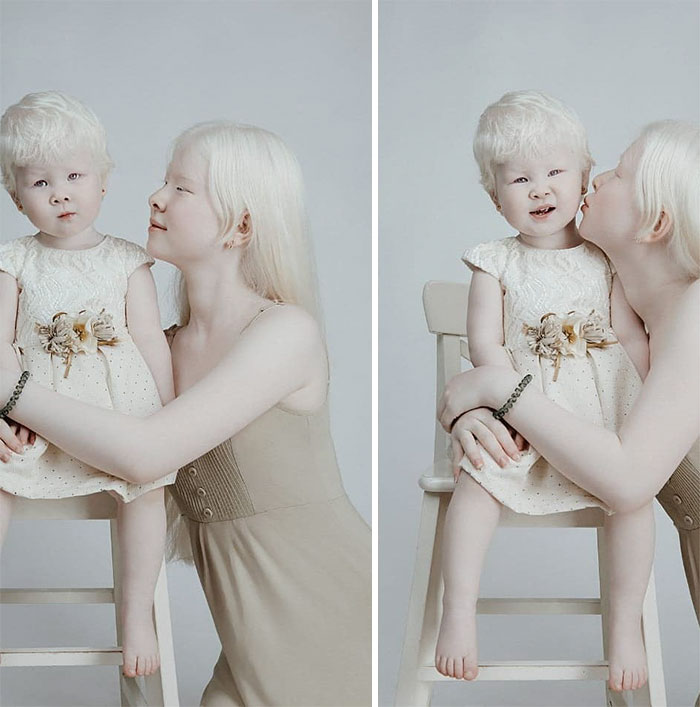 Albino Sisters Born 12 Years Apart Stun The World With Their Extraordinary Beauty (24 Pics)