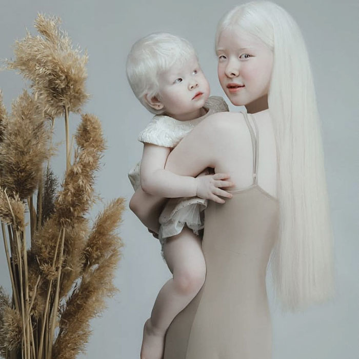 Albino Sisters Born 12 Years Apart Stun The World With Their Extraordinary Beauty (24 Pics)