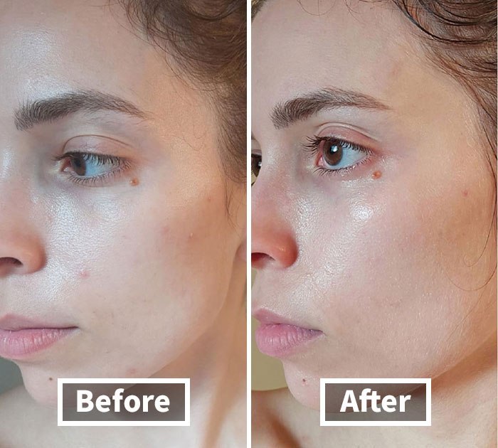 Dive Into Deep Comfort: Cosrx Balancium Packs A Ceramide Punch!