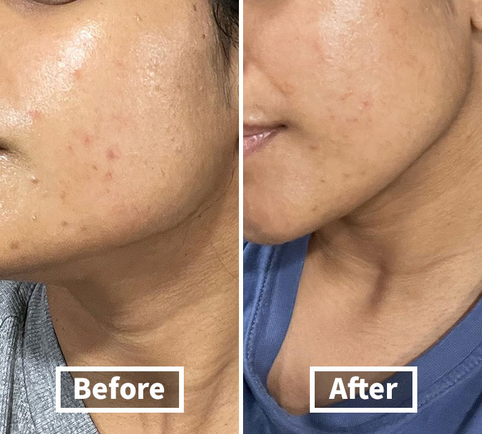  Anua's Heartleaf Toner: The Soothing Superhero Your Skin Deserves!