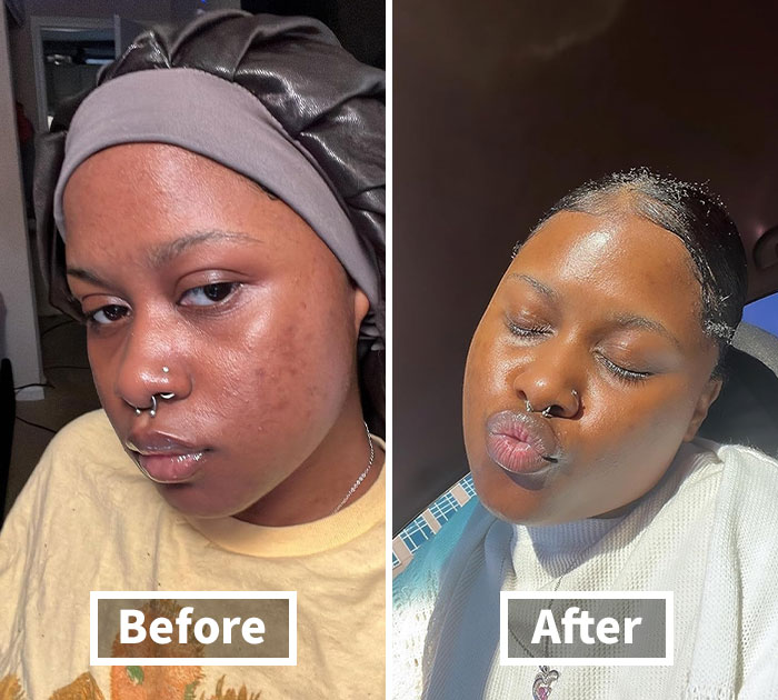 Unbeanlievable Glow: Mixsoon Bean Essence for Radiant Skin!