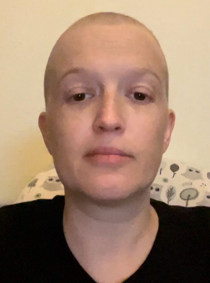 Hey Pandas, I Need Help And Support For My Cancer And Chemotherapy Journey