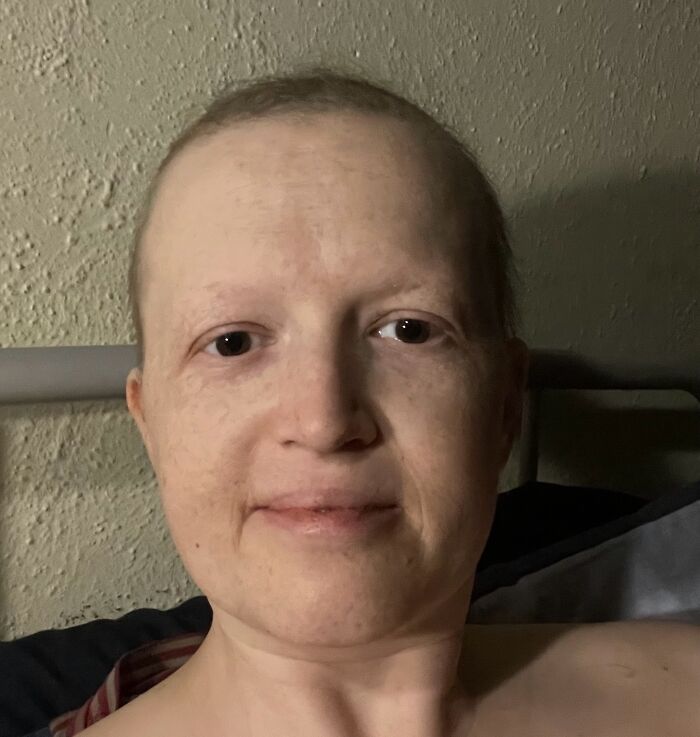 Hey Pandas, I Need Help And Support For My Cancer And Chemotherapy Journey