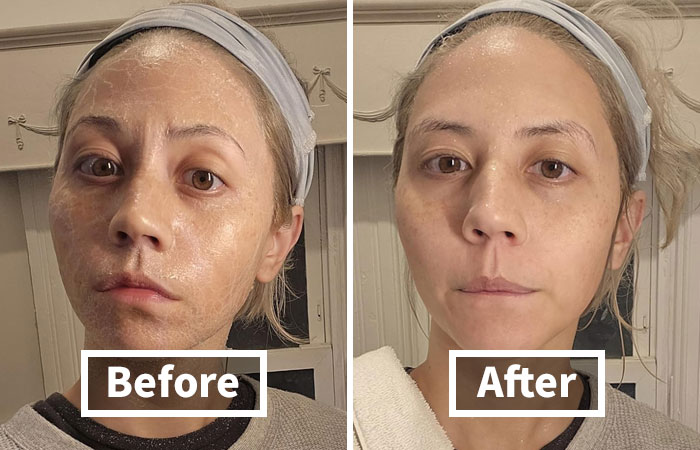  SKIN1004 Zombie Pack: Revitalize Your Skin With 8 Hydrating Treatments In 1 Box! Unleash The Power Of Rejuvenation!