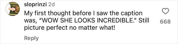 &ldquo;The Reality Of Motherhood&rdquo;: Serena Williams Posts Bikini Pic To Promote Body Positivity After Pregnancy