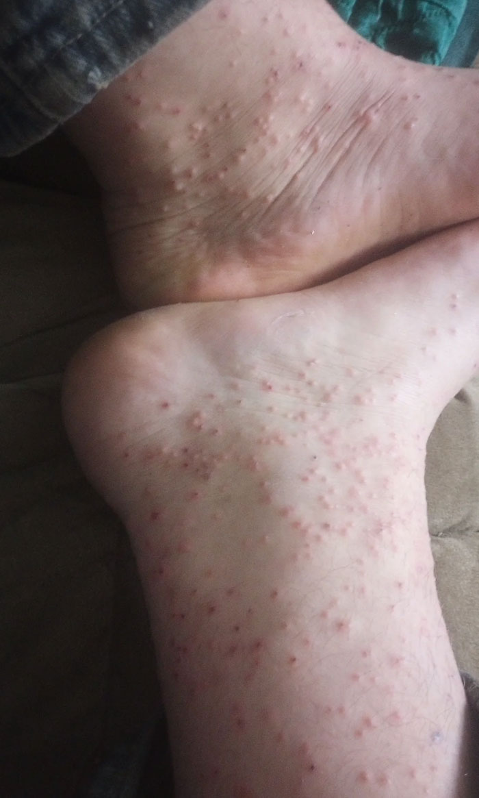 Doesn't Necessarily Hit Home As Some Other Posts But I Am Very Much Suffering