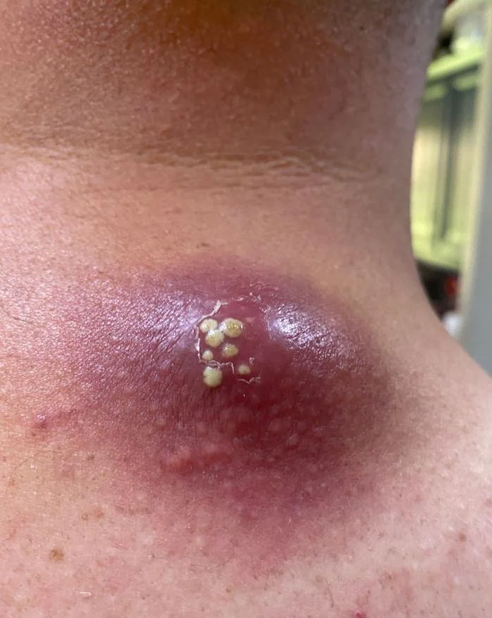 Me acaban de explotar esto en el hospital