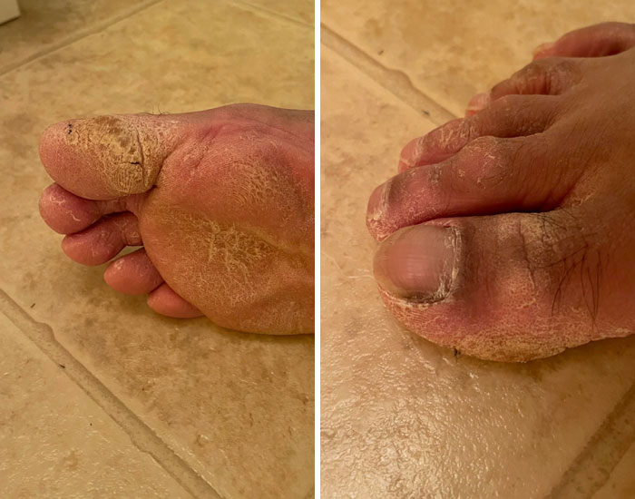 Can Somebody Tell Me What Exactly Is Up With My Foot? How Can I Fix This?