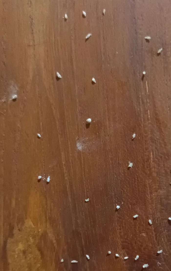 My Acne Starts Breaking Out Again, Here's Some Of The Whiteheads