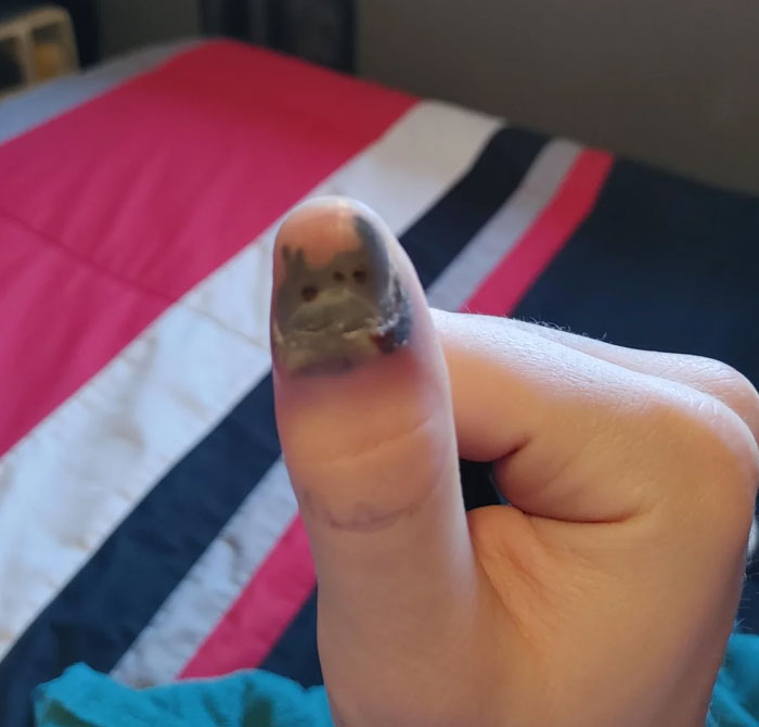 Me he pillado el dedo en una prensa hidráulica en el trabajo, sigo teniendo dedo, no me he roto nada, pero se ve horrible