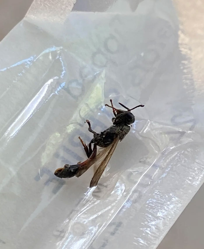 Acabo de sacar esto del oído de un paciente