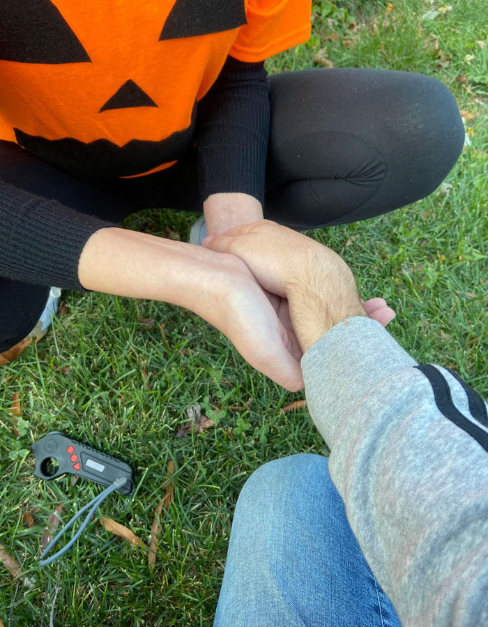 My Broken Wrist(Needed Surgery)