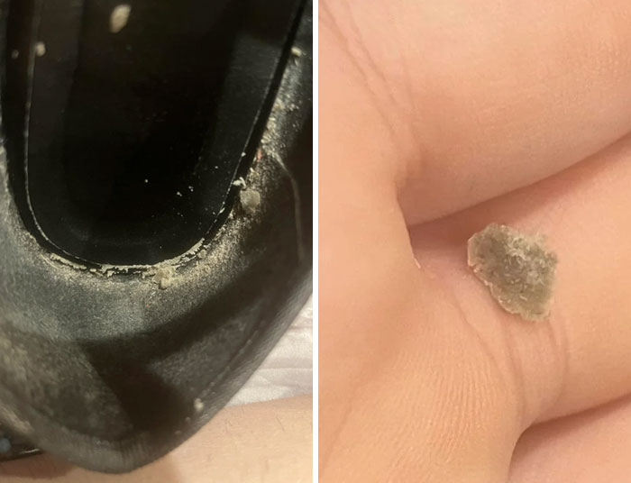 Everytime I Wear My Shoes This Happens (Pretty Sure It’s Dead Skin Cells)