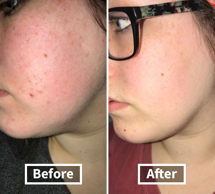  CeraVe Moisturizing Cream, The Game-Changing Skincare Savior You Need To Battle Dry Skin, Developed By Dermatologists For 24/7 Maximum Hydration.