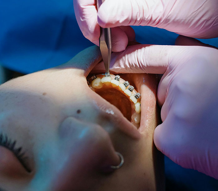 “Not 30% Chance Of It Raining”: Simple Concepts Unknown To People Outside These Fields Of Study