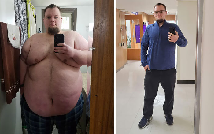 Hard Work Pays Off. From 525 Lbs To 225 Lbs