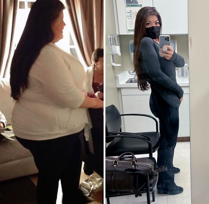 From 350 Lbs To 170 Lbs. Lost 180 Lbs In Total. Struggling Because I Am Still "Obese" But It Is Progress Nonetheless