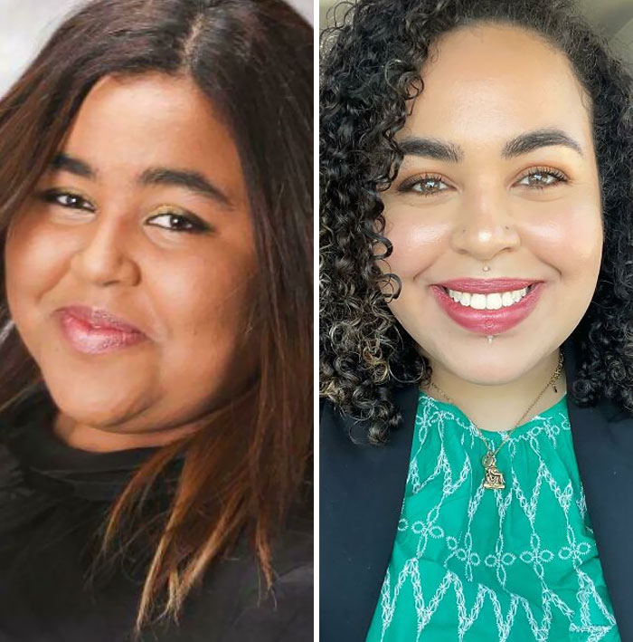 From 295 Lbs To 210 Lbs. Lost 85 Lbs. Face Gains Are The Best Surprise