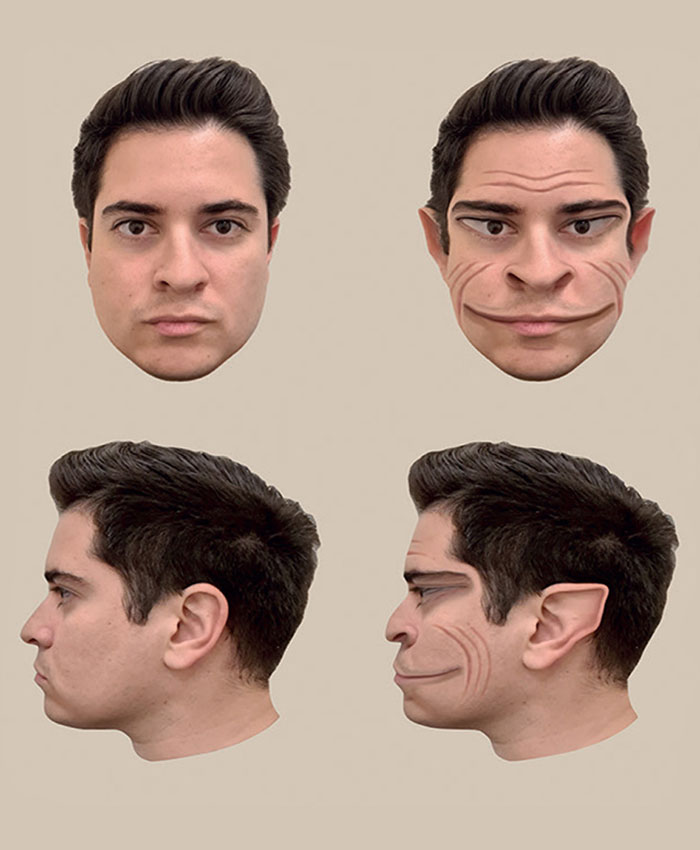 Man With Rare Disorder With Less Than 100 Reported Cases Sees People Like Demonic Figures - 1