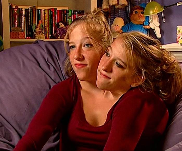 Conjoined Twins Brittany and Abby Fire Back At Negative Comments On Abby&rsquo;s Marriage To Josh