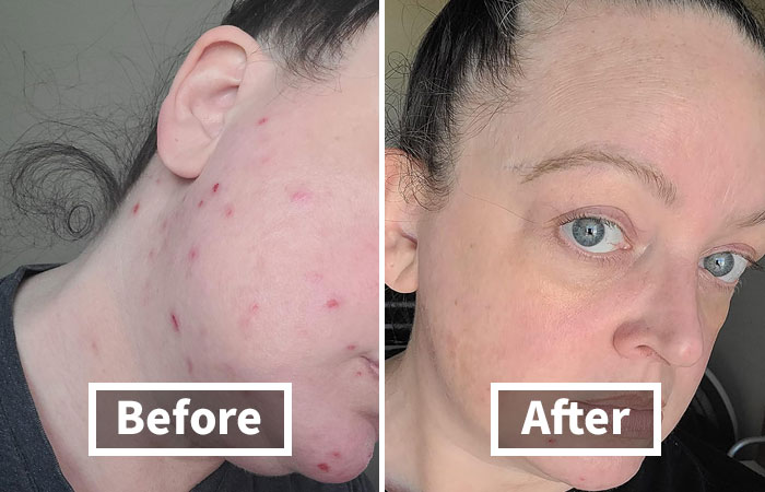 Wipe Away Your Worries With Clean Towels Xl