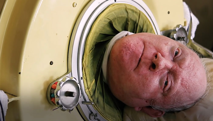 “Polio Paul” Passes Away After Spending 70 Years In Iron Lung, Leaves Impressive Legacy “Polio Paul” Passes Away After Spending 70 Years In Iron Lung, Leaves Impressive Legacy