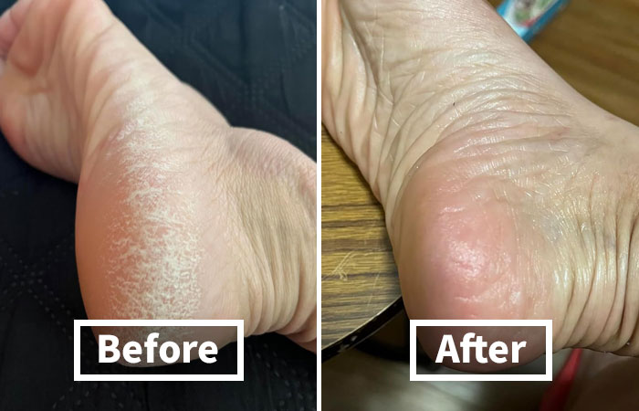  Lee Beauty: The Home Pedicure Foot Spa You Need