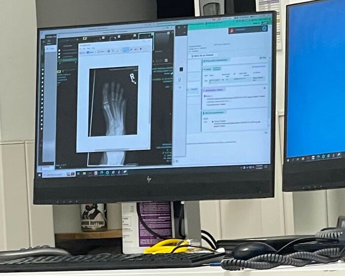 Woman Says The Bond With Her Cat Was Strengthened After The Cat Sneakily Consumed Her Toe