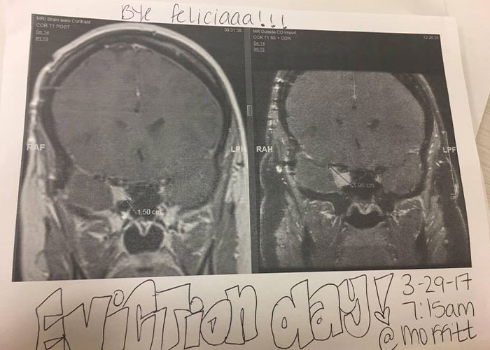 Woman’s Selfie Near Times Square Leads To Brain Tumor Diagnosis Woman’s Selfie Near Times Square Leads To Brain Tumor Diagnosis