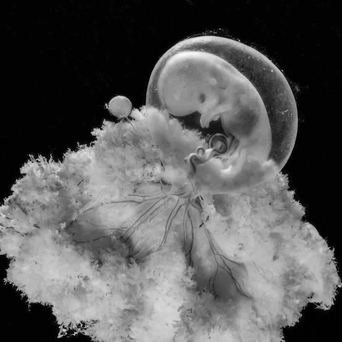 19 Groundbreaking Images By This Photographer Offering A Glimpse Into The Miracle Of Birth